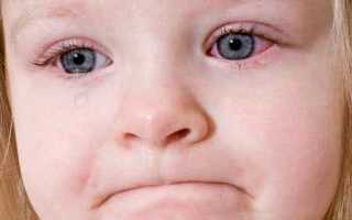 Почему у ребенка слезятся глаза