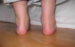 После высокой температуры у ребенка начали болеть ноги – почему так происходит?