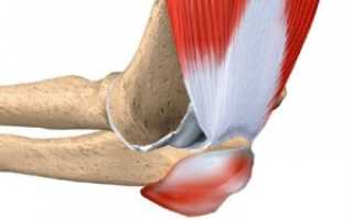Чем и как правильно лечить локтевой бурсит, рекомендации врачей