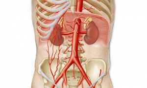 Что такое аневризма аорты брюшной полости?