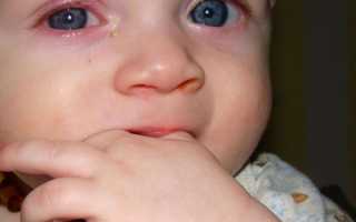 У ребенка красные глаза и высокая температура: причины и способы лечения