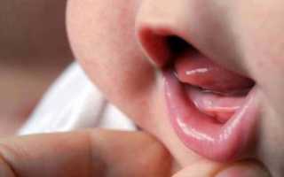 Повышенная температура у ребенка при прорезывании зубов