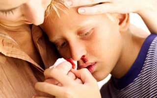У ребенка из носа течет кровь при высокой температуре